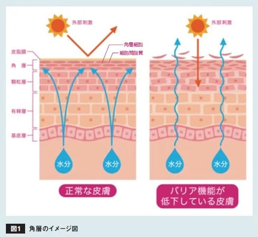 正常な皮膚とバリア機能が低下した皮膚での水分保持の違いを示す角層の模式図